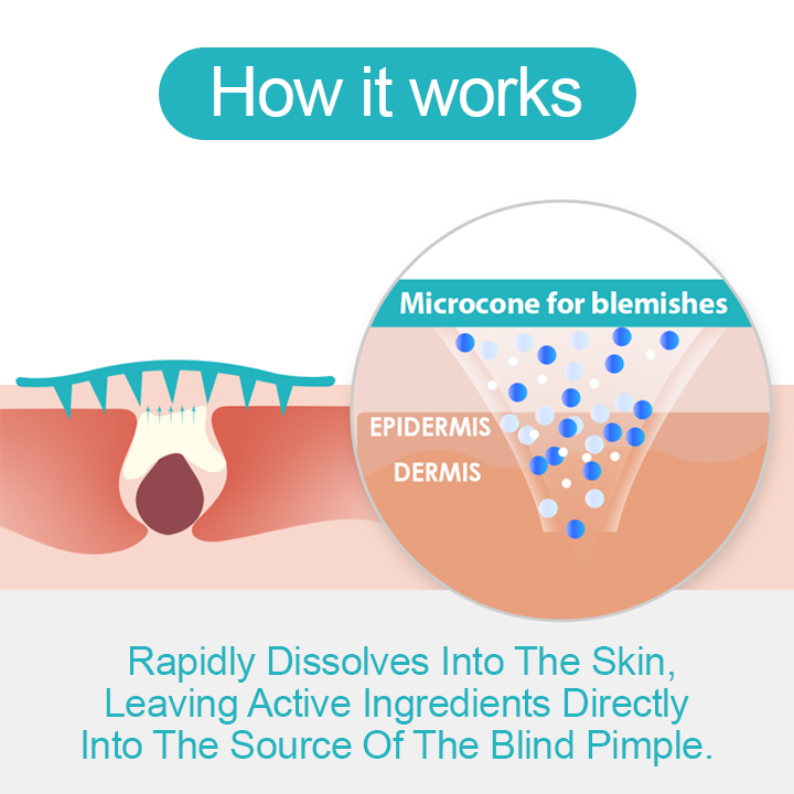 LIMETOW™ Microneedle Spot Clearing Patch