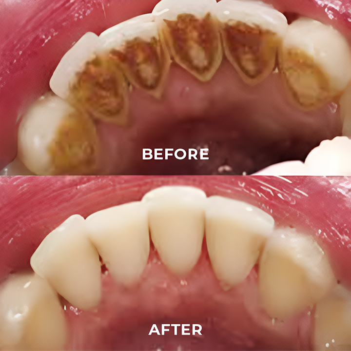 MEDix™ Dental Cleansing Mouthwash