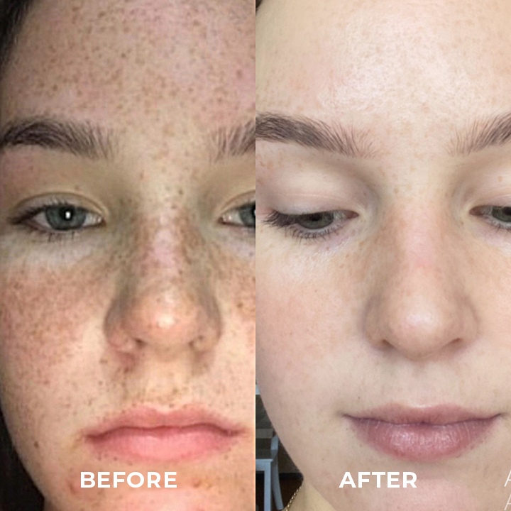 SOUTHERN RI™ Whitening Freckle Removal Cleanser
