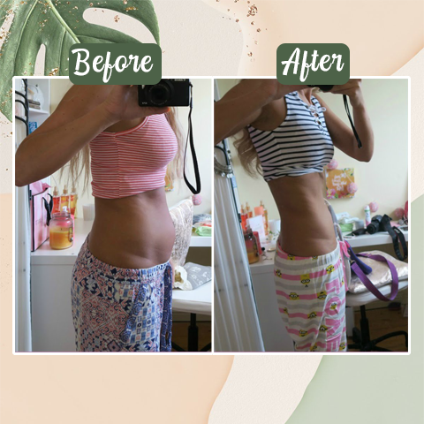 Perfect™ Detox Slimming Patch