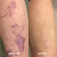 ProRegen™ Medical Scar Removal Spray